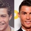 ronaldo-chirurgie