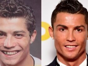 ronaldo-chirurgie